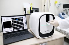 조혈모세포 검사 빨라진다…울산대병원, 차세대 장비 도입
