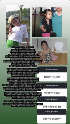 우서윤 성형 논란에…정연우 "무례하고 가치없는 말"