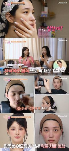 율희, 피부 왜 이러나 "안면비대칭에 셀카 찍기 싫어"