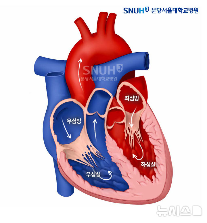 심부전, 같은 치료에도 사망 위험 5.7배↑…왜?