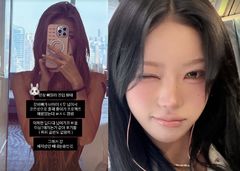 "갈비뼈 너무 넓어서"…최준희, '뼈말라' 위해 흉곽 교정 시도