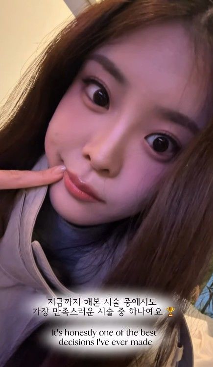'우지원 딸' 우서윤, '미코 진' 후 치아시술 고백 "자신 있게 웃어"
