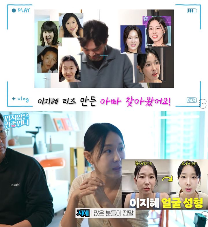 이지혜, 리프팅 받고 확 달라졌나…"많이 좋아졌다고"