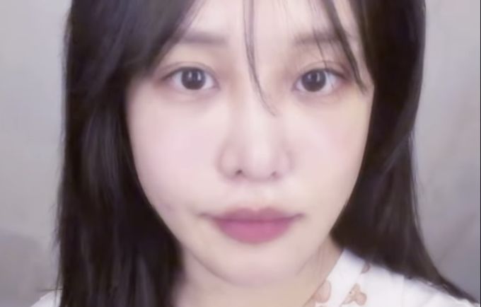 우리가 알던 랄랄 맞나?성형 수술 한달 후 근황