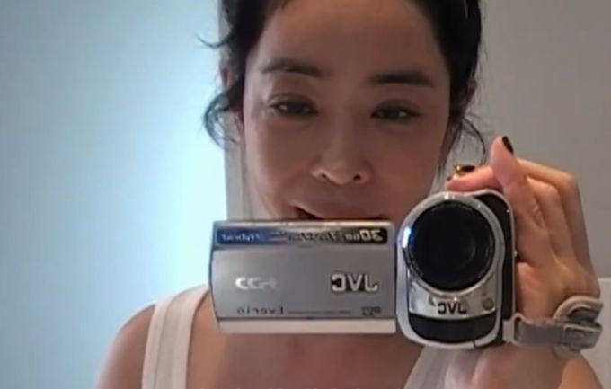  이혜영, 폐암수술 흉터 공개 "수술부위 유착되면서 통증"