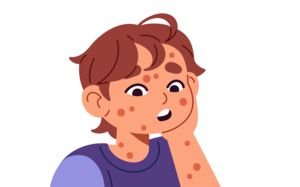 "온몸에 붉은 반점"…새학기 수두 유행 비상