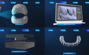 이젠 치아 교정도 AI로…"이물감 없어요"