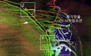 뇌 노폐물 배출구멍 발견…'치매' 정복길 열리나