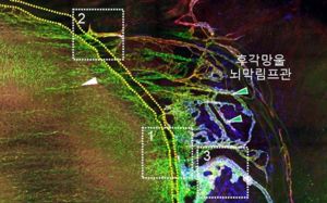 뇌 노폐물 배출 구멍 첫 발견…치매 정복길 열리나