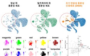 치매 악화 스위치 찾았다…단백질 하나 억제하니 기억력 회복