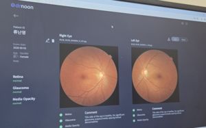 "당신은 심혈관질환 위험군"…AI, 눈만 봐도 안다