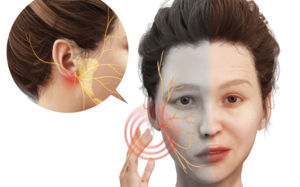 "입 돌아가고 눈이 안감겨요"…말초성 안면마비?