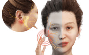 갑자기 펴진 얼굴 주름…'안면마비' 전조일수도