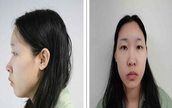 '모텔 연쇄살인' 약물 피해자 3명 추가 확인