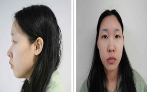 '모텔 약물 연쇄살인' 김소영, 1심서 무기징역