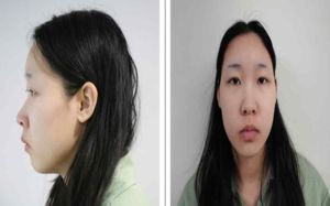'모텔 약물 연쇄살인' 김소영, 1심서 무기징역
