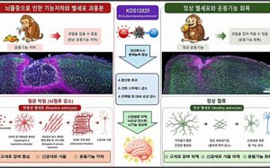 뇌졸중 새 치료법 찾았…"동물시험서 규명"